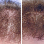 Vorher-nachher-Vergleich: Deutlich dichteres und kräftigeres Haar – Vitame Hair Power unterstützt Haarwachstum und Fülle