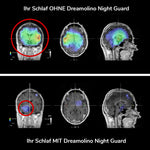 05_Dreamolino_NightGuard_Schlaf.jpg