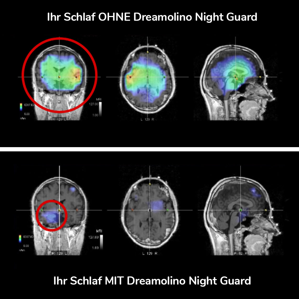 05_Dreamolino_NightGuard_Schlaf.jpg